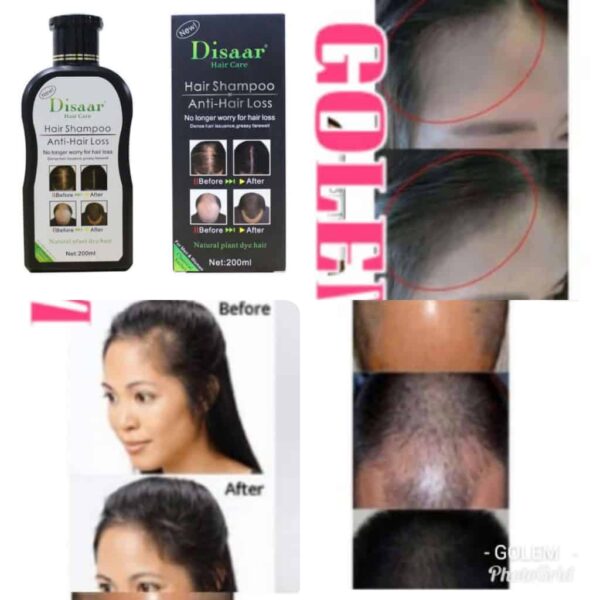 Crème cheveux contre l'alopécie et la calvitie Disaar
